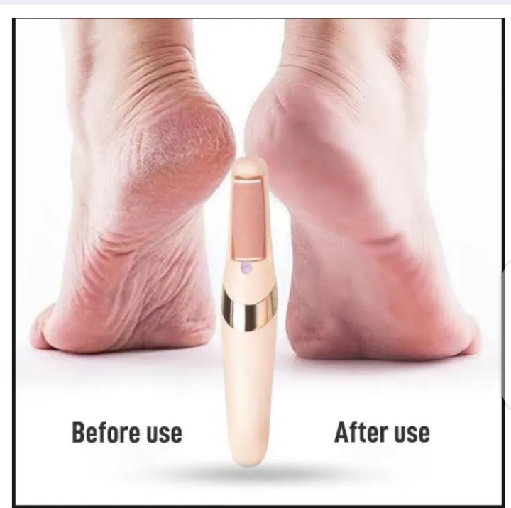 100% BRANDED FIND BACK Electric Foot File Grinder Foot Pedicure Tool Dead Skin Callus Remover Machine