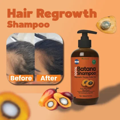 Hair Growth Batana Hair Oil 120ml | Anti Hair Fall Oil | Amla Reetha Shikakai | Bint E Hawa | For Men & Women