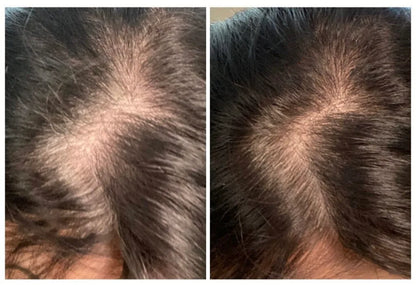 Hair Growth Batana Hair Oil 120ml | Anti Hair Fall Oil | Amla Reetha Shikakai | Bint E Hawa | For Men & Women